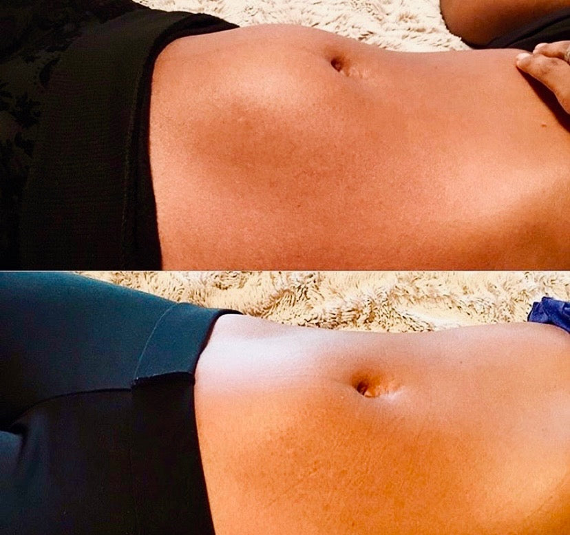 Before and After